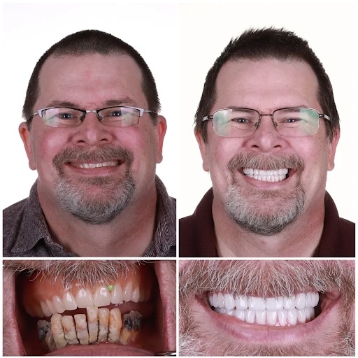 Dental
