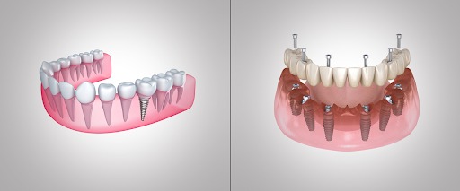 Dental