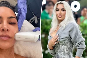Kim Kardashian Sofwave Skin Treatment Guide and Results